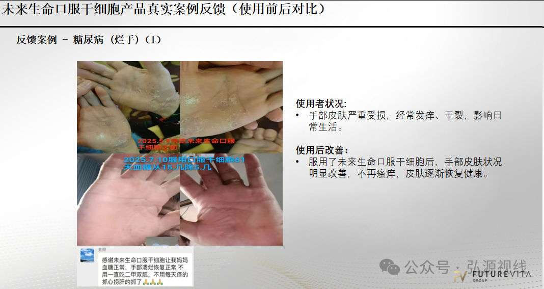 “Futurevita未来生命”：包装成海外健康项目，能治疗各种疾病？(2)